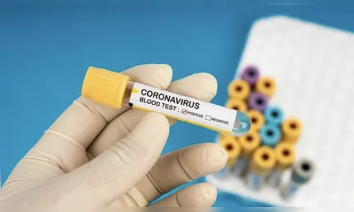 Maringá tem 7 casos confirmados do novo coronavírus e 48 suspeitos; município tem 2 óbitos pela doença 