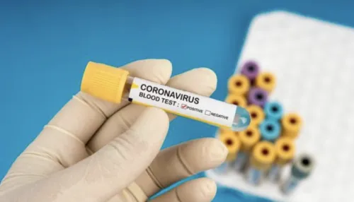 Maringá tem 7 casos confirmados do novo coronavírus e 48 suspeitos; município tem 2 óbitos pela doença 