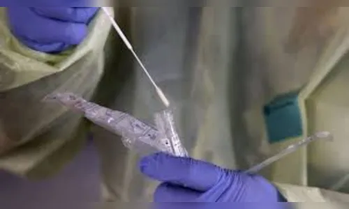 SP tem 12 mil exames para covid-19 em análise, mas processa 3 mil por dia