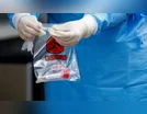 Covid-19: 500 mil kits de teste rápido chegam ao Brasil