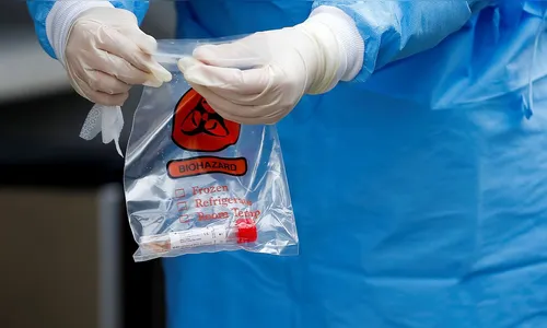 Covid-19: 500 mil kits de teste rápido chegam ao Brasil
