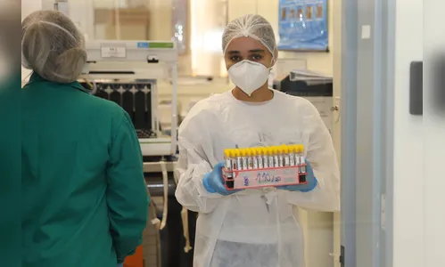 Bolsistas já estão atuando e ajudam a desafogar trabalho do Lacen