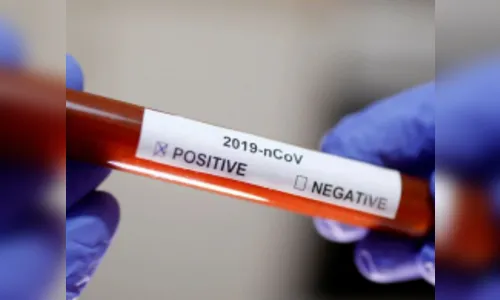 Sobe para 7 o número de casos de Covid-19 em Arapongas