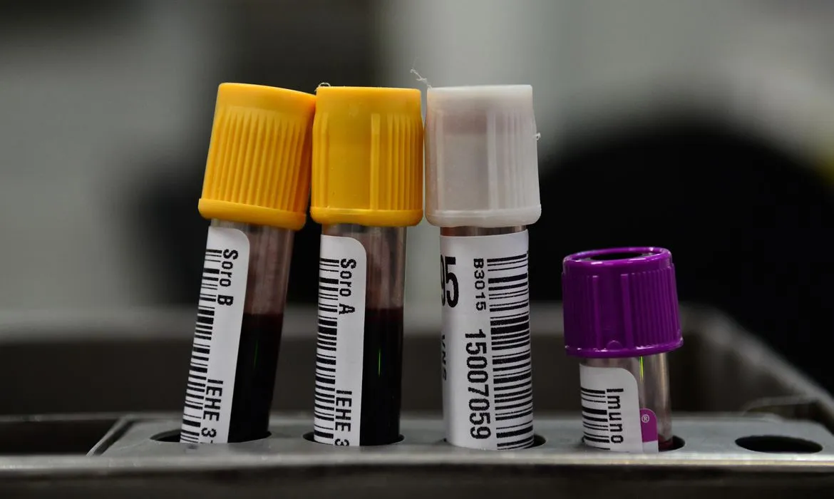 Hemorio inicia testes com plasma sanguíneo no tratamento de covid-19