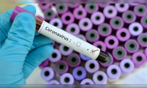 Farmacêutica é oitavo caso de coronavírus confirmado em Arapongas