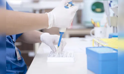 Sima compra 500 testes para Covid-19 e doa para a Prefeitura de Arapongas