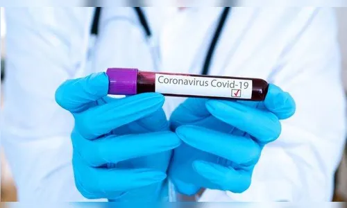 Boletim coronavírus: 34 novos casos e dois óbitos