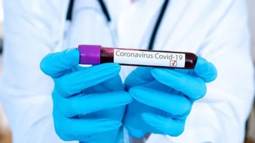 Boletim coronavírus: 34 novos casos e dois óbitos