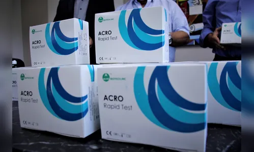 Sima entrega 500 testes para Covid-19 na Prefeitura de Arapongas 