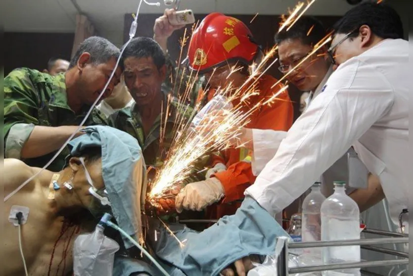   Os médicos tiveram de pedir ajuda aos bombeiros e aos colegas de Zheng para que eles limassem o metal antes de removê-lo cirurgicamente 