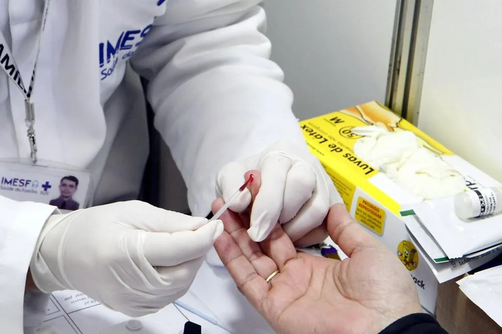 Teste HIV (Foto: Evandro Oliveira/PMPA)