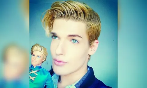 Após complicações com hidrogel, Ken humano pensa em desistir da carreira