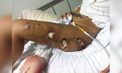 Agência divulga fotos de Andressa Urach no hospital