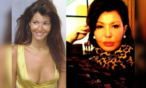 ​Roberta Close se irrita com críticas após modificações no rosto