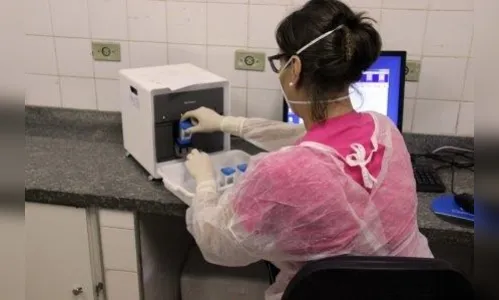 Técnica permite identificação quase imediata da tuberculose