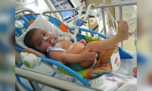​Marca-passo é implantado em bebê com doença rara de Rolândia