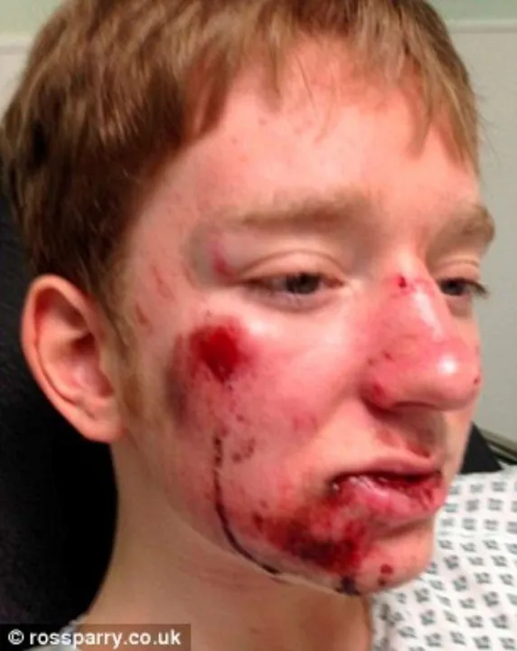O jovem atropelado foi levado para um hospital. Felizmente, estaria usando um capacete - Foto : Foto: Daily Mail / Reprodução 