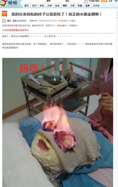 Foto de tratamento bizarro foi postada em fórum chinês (Foto: Reprodução)
