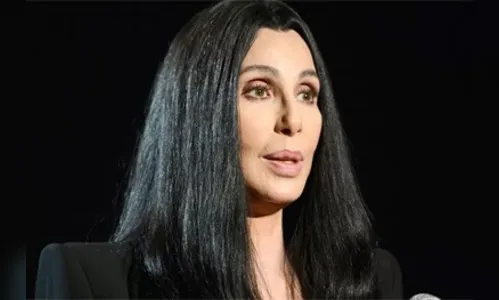 Cher pode estar morrendo por falha nos rins e coração
