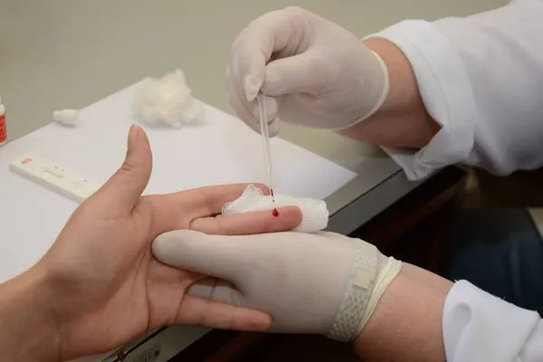 Casos de hepatites virais crescem 66% em Apucarana