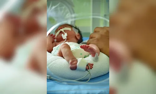 Mortalidade infantil cresce 48% na região
