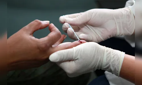 UBS realiza testes rápidos na UTFPR de Apucarana