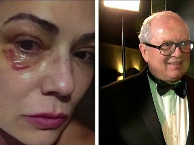 Luiza Brunet se separou do empresário Lírio Parisotto  após agressão - Foto: Reprodução / TV Globo