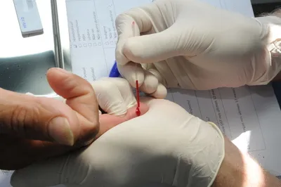 Estado vai ofertar testes de HIV em trailer itinerante - Foto: Divulgação SESA