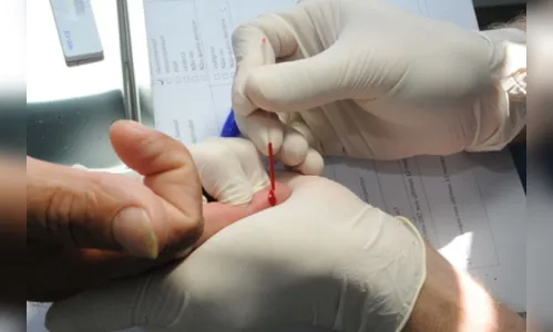 Estado vai ofertar testes de HIV em trailer itinerante  