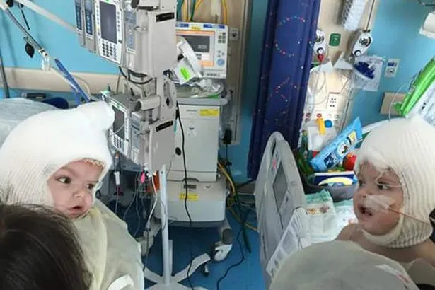  A mãe dos gêmeos achaou incrível o resultado da cirurgia de separação  - Foto: Facebook
