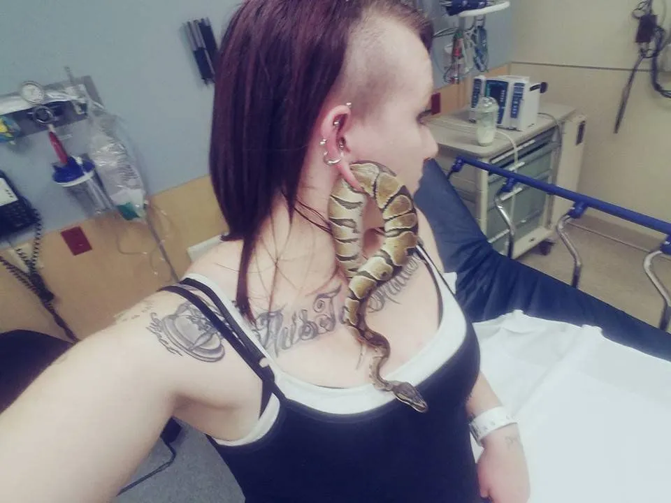 Cobra ficou presa no  no lóbulo da orelha direita de Ashley Glawe - Foto: Facebook/Ashley Glawe