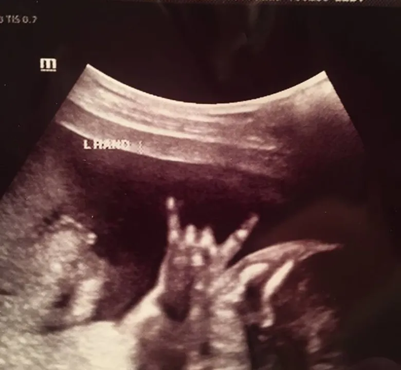 Makelle Ahlin postou foto de um ultrassom em que seu futuro bebê parece fazer o sinal da "mão-chifrada" - Foto: Makelle Ahlin/Facebook