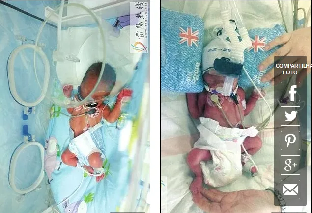 ​Os bebês estão ainda sob cuidados especiais na incubadora - Foto:  China News Service