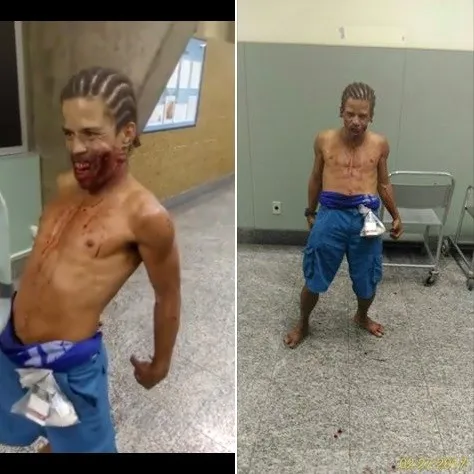 Jovem ferido fez a 'dança de Satanás' em corredor de hospital público -  Reprodução/Facebook