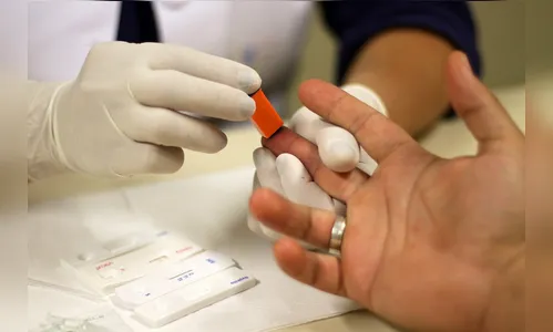 Unidade Básica de Saúde realiza testes de hepatite C e Siflis 