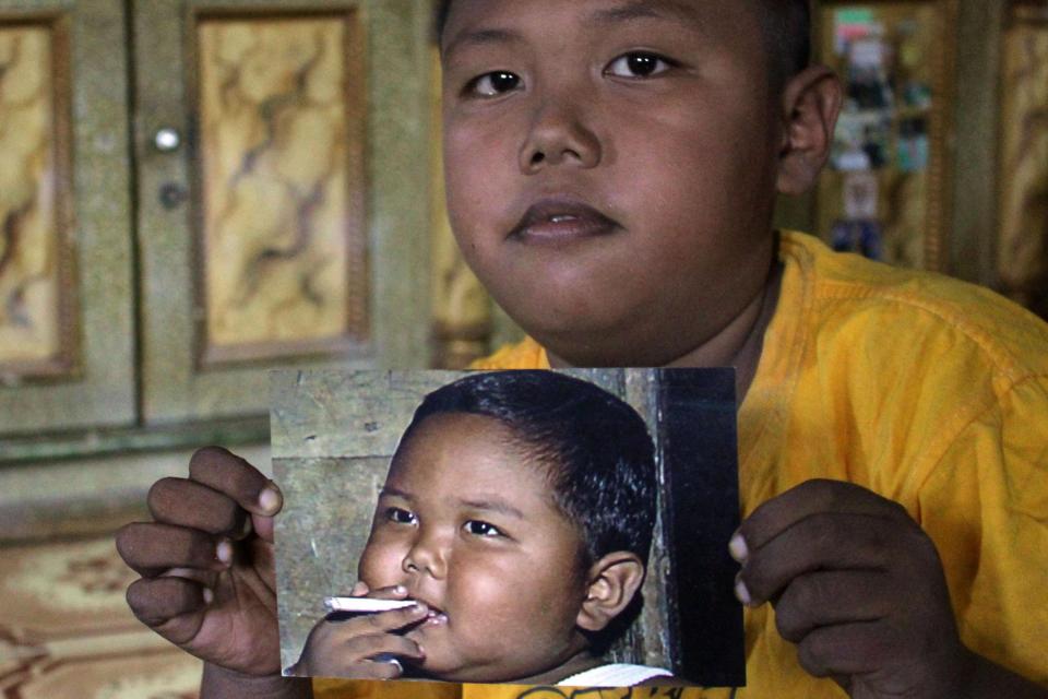 Veja como está hoje o menino que fumava 40 cigarros aos 2 anos