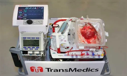 
							Máquina faz com que coração continue batendo fora do corpo; veja vídeo
						
						