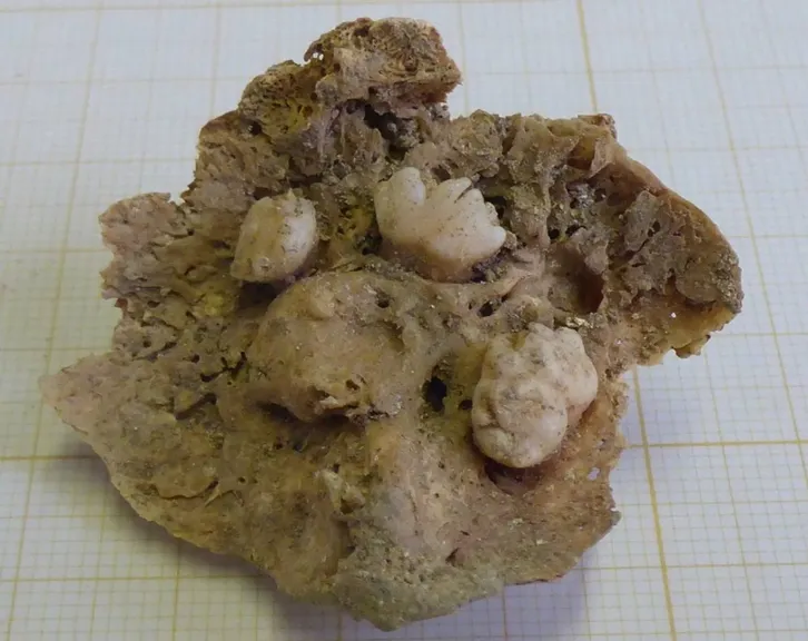 Massa calcificada com o tumor / Foto:  Sofia N. Wasterlain - Jornal Internacional de Paleopatologia