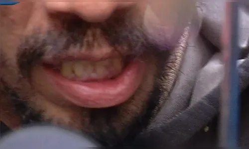 Pai é solto após esfaquear a filha de 14 anos