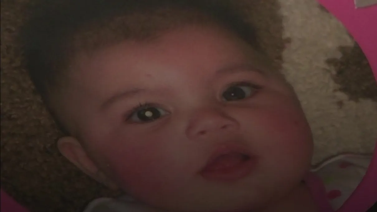 Foto de Rose, aos seis meses, levou a diagnóstico de retinoblastoma (Foto: BBC)